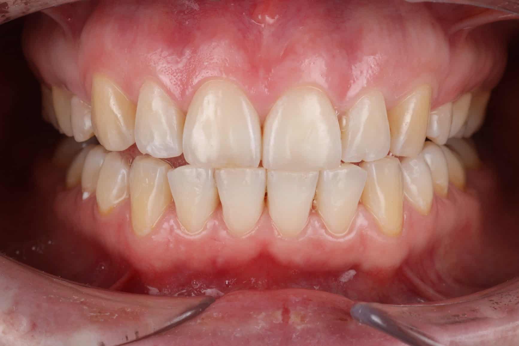 Profesjonalna Stomatologia w Warszawie - Parodent